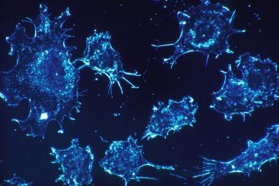https://www.funerariadeguardia.com/almacen/noticias/img_cancercells5419541280.jpg